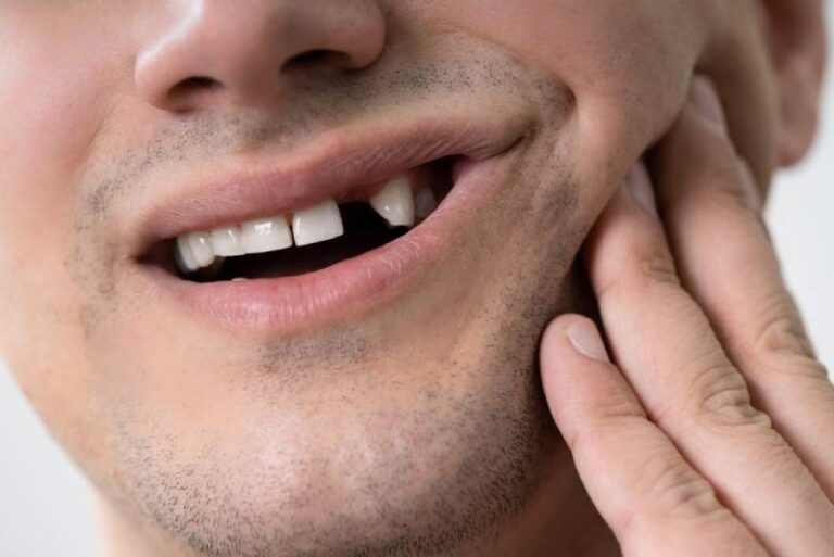 Mơ Thấy Gãy Răng Đánh Số Gì? Gãy Răng Có Đem Lại May Mắn?