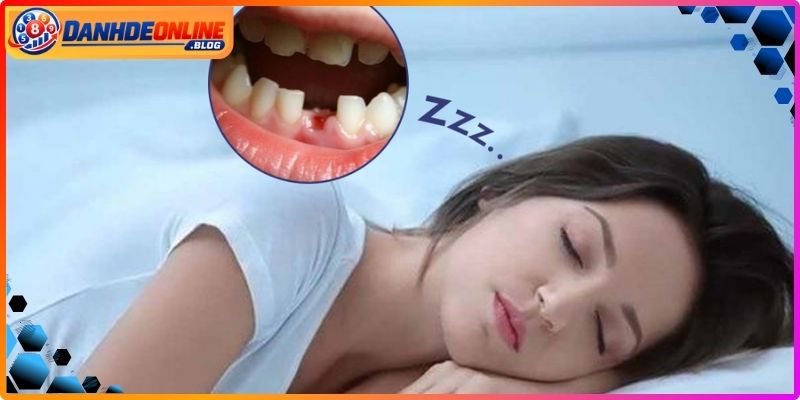 Mơ Thấy Rụng Răng - Giải Mã Điềm Báo, Chốt Số Chuẩn 3 Những trường hợp nằm mộng gãy rớt chân nhai hay gặp